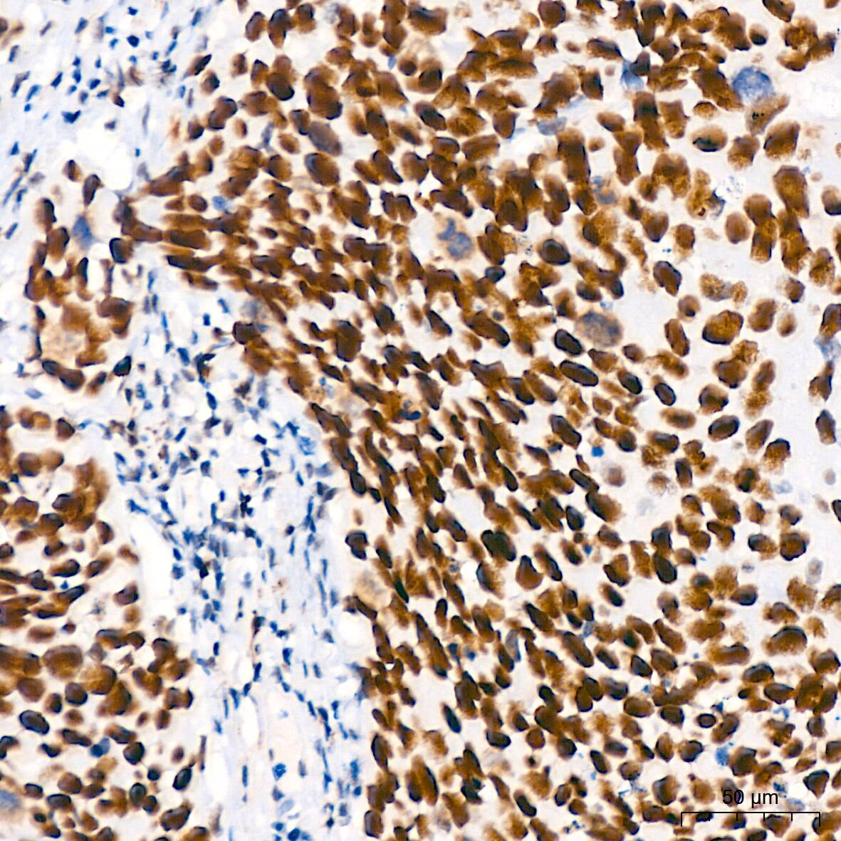 TCF7L2 Antibody (1W10T6)
