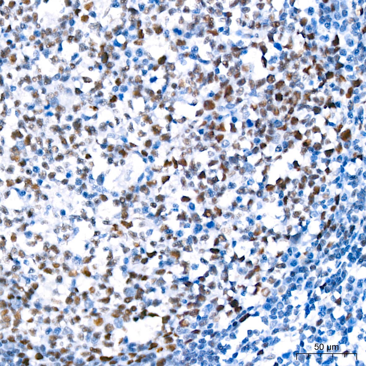 TCF7L2 Antibody (1W10T6)