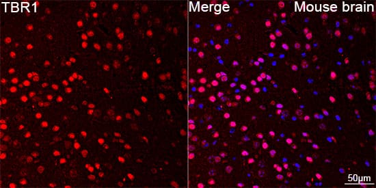 TBR1 Antibody (1U1K5)