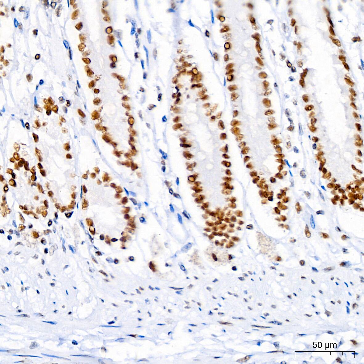 Brg1 Antibody (4N9C4)