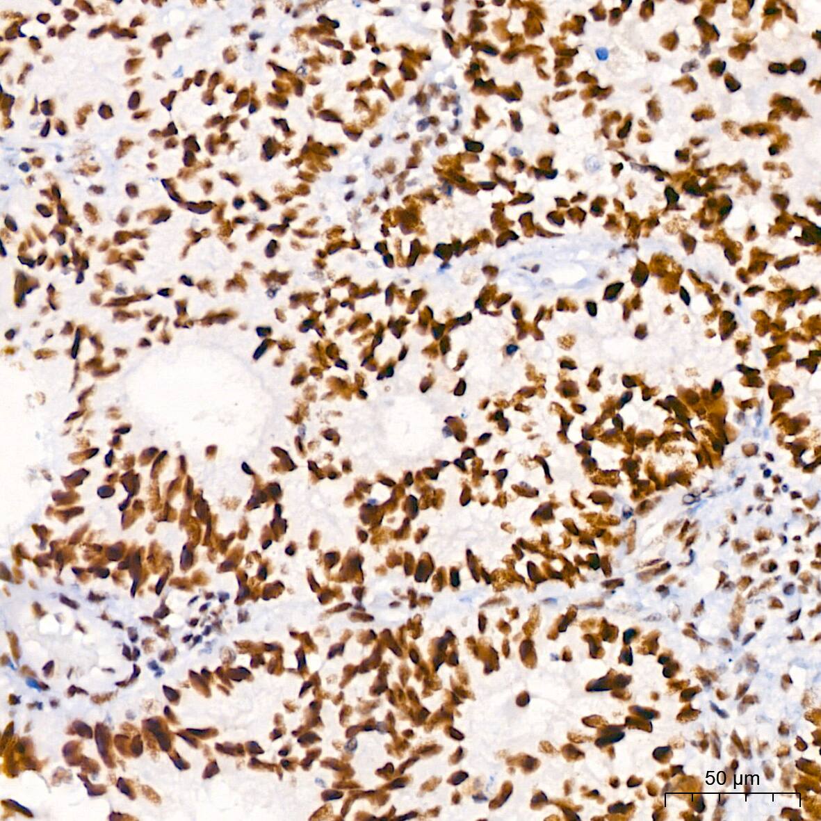 Brg1 Antibody (4N9C4)