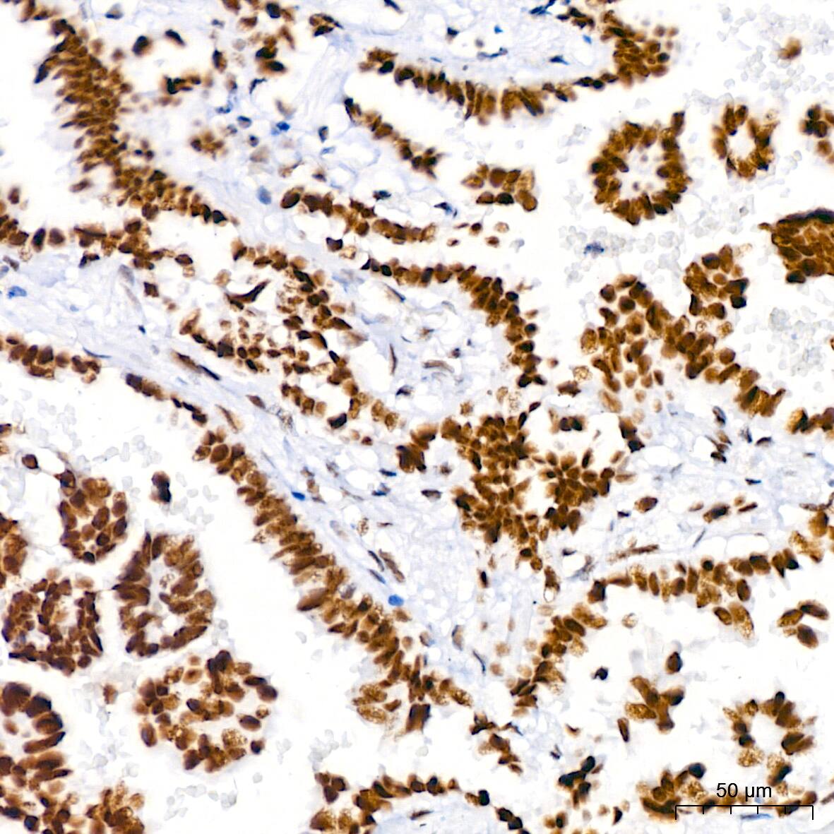Brg1 Antibody (4N9C4)