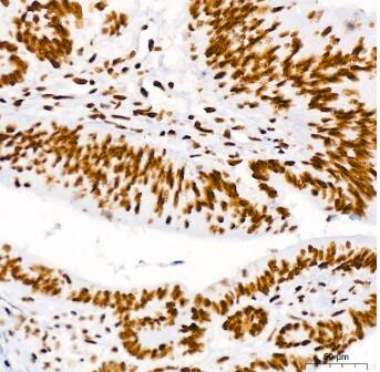 Brg1 Antibody (4N9C4)