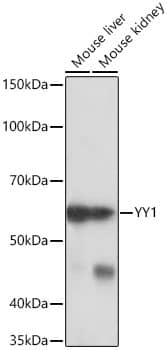 YY1 Antibody (6J6L1)