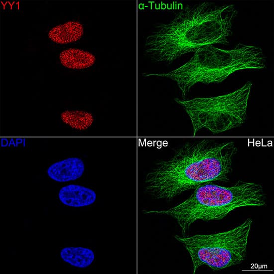 YY1 Antibody (6J6L1)