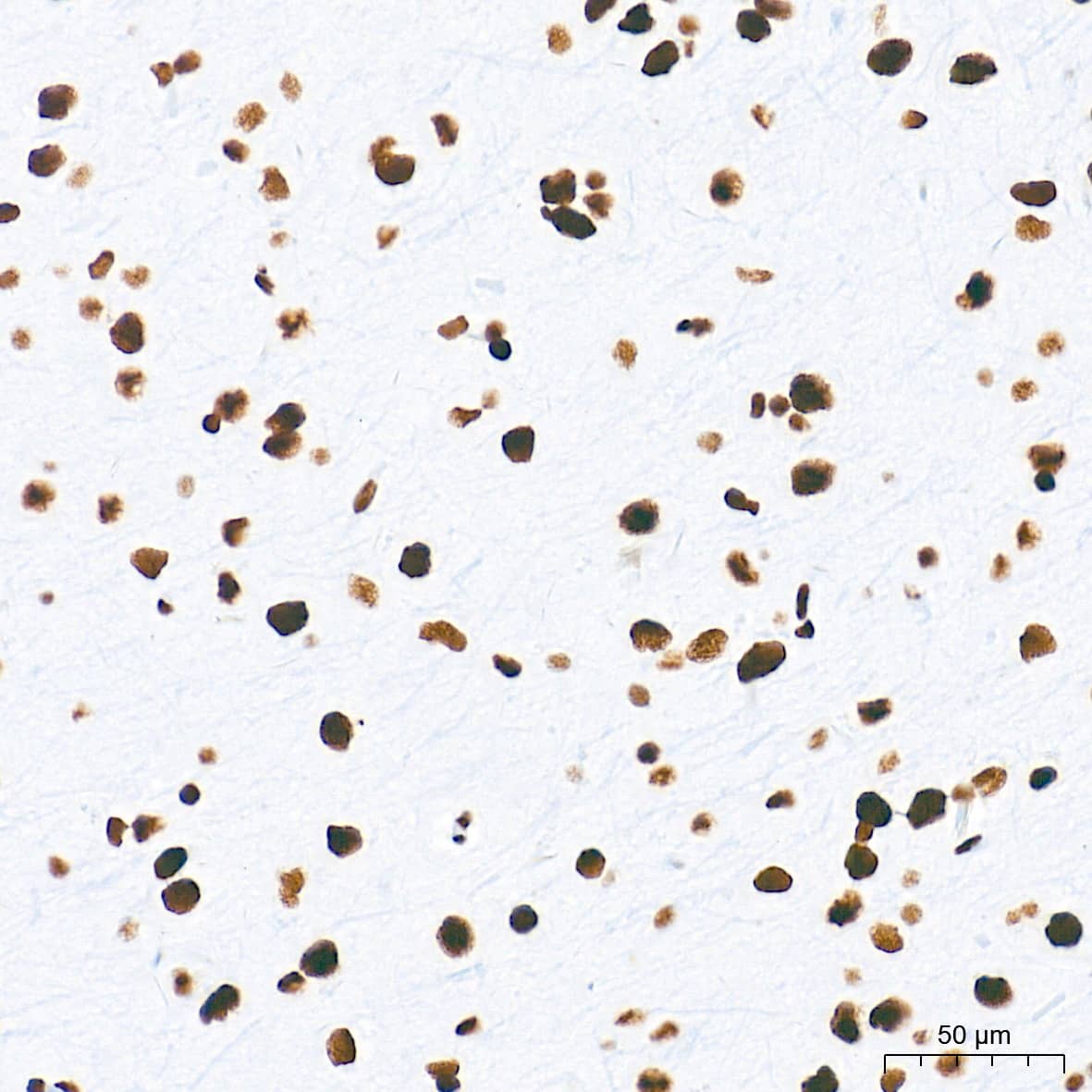 HDAC1 Antibody (2L6O7)