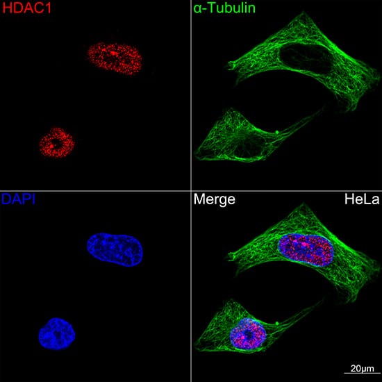 HDAC1 Antibody (2L6O7)