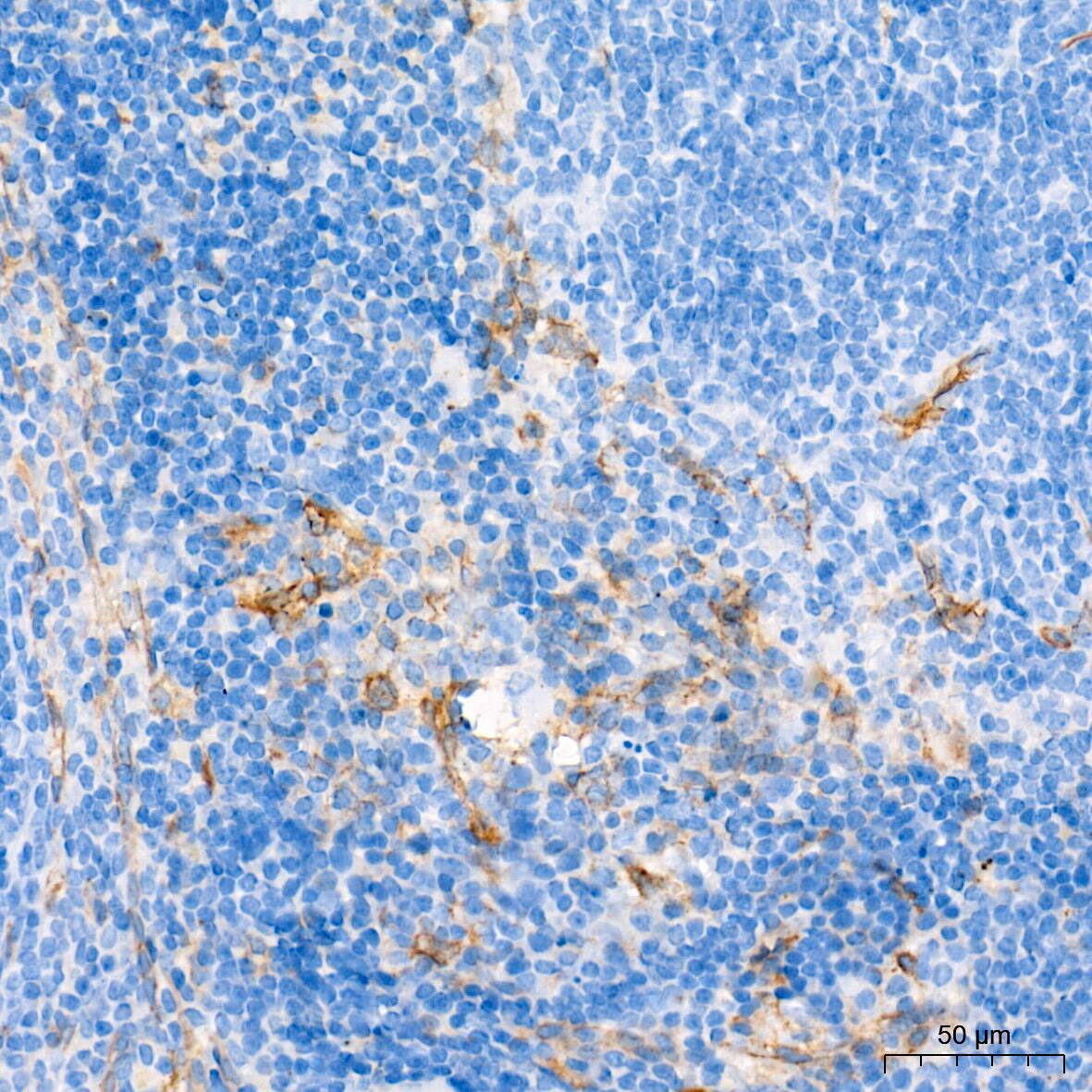 Dysferlin Antibody (3U1P9)