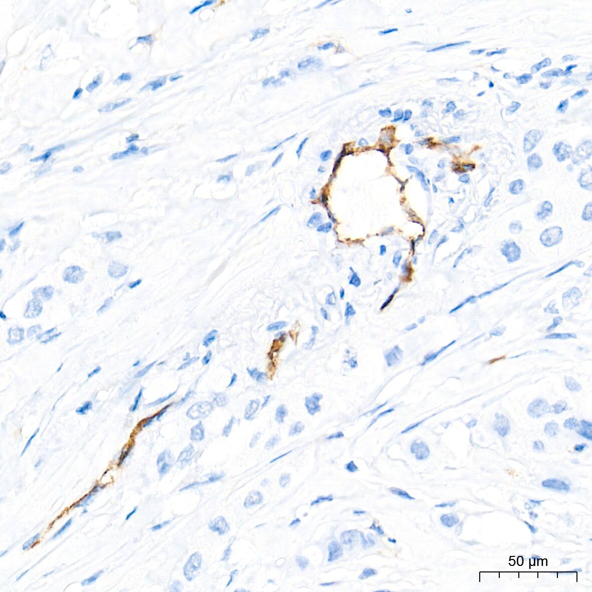Dysferlin Antibody (3U1P9)