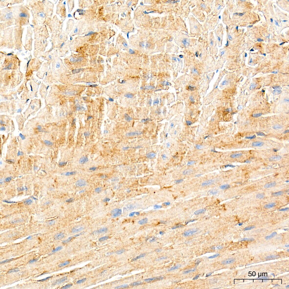 Dysferlin Antibody (3U1P9)