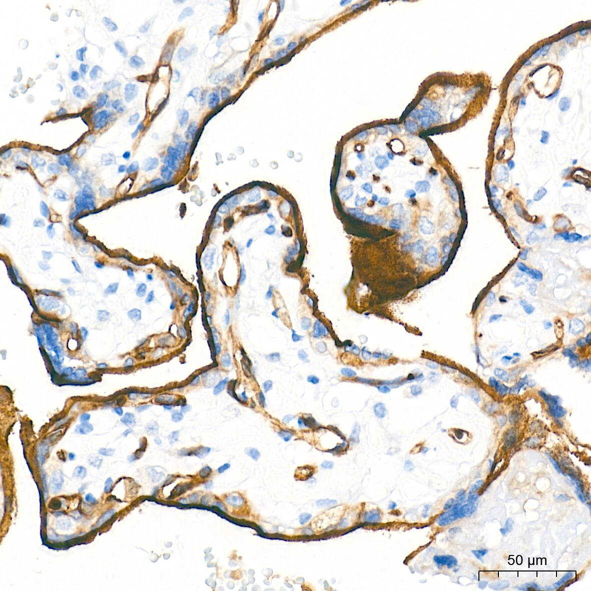Dysferlin Antibody (3U1P9)