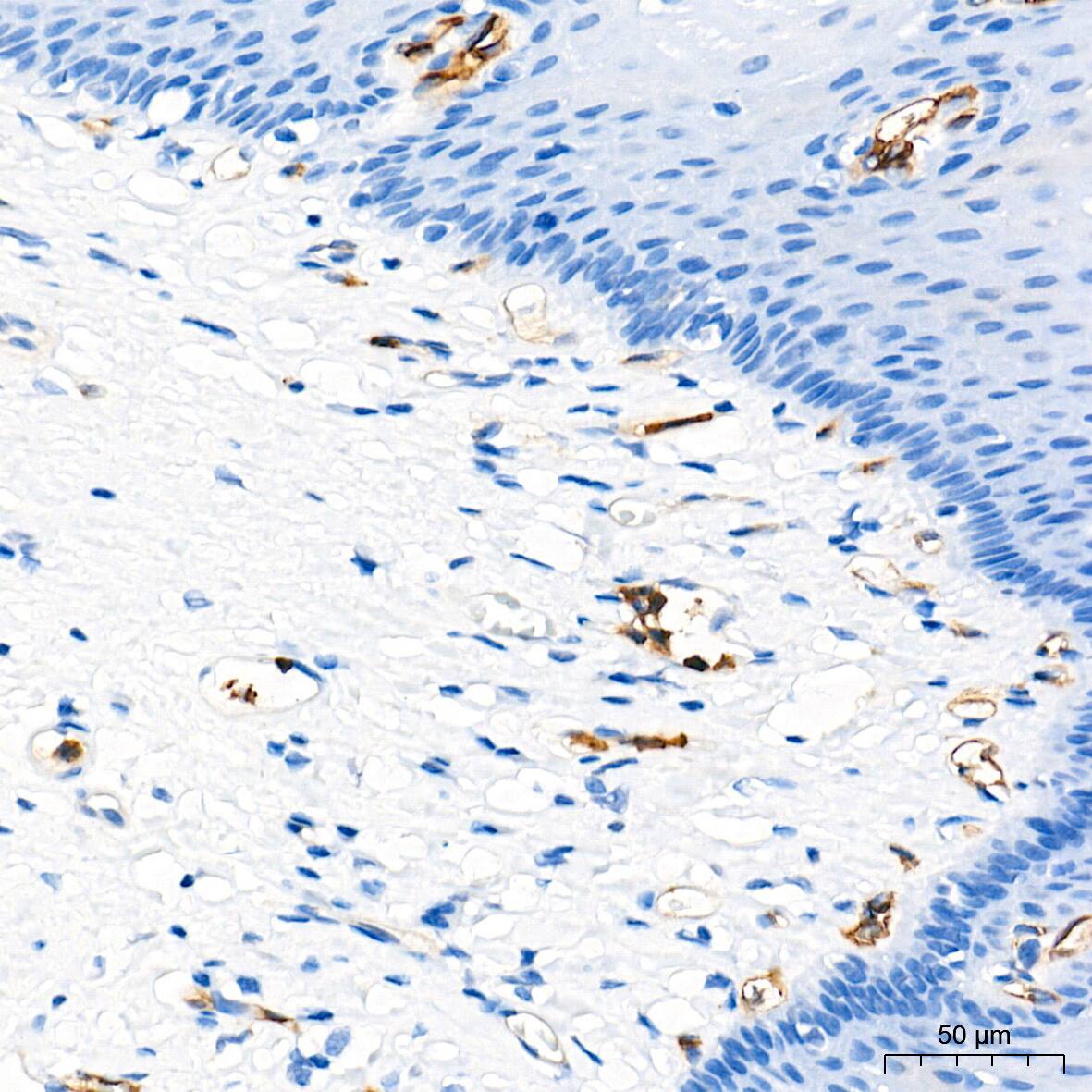 Dysferlin Antibody (3U1P9)