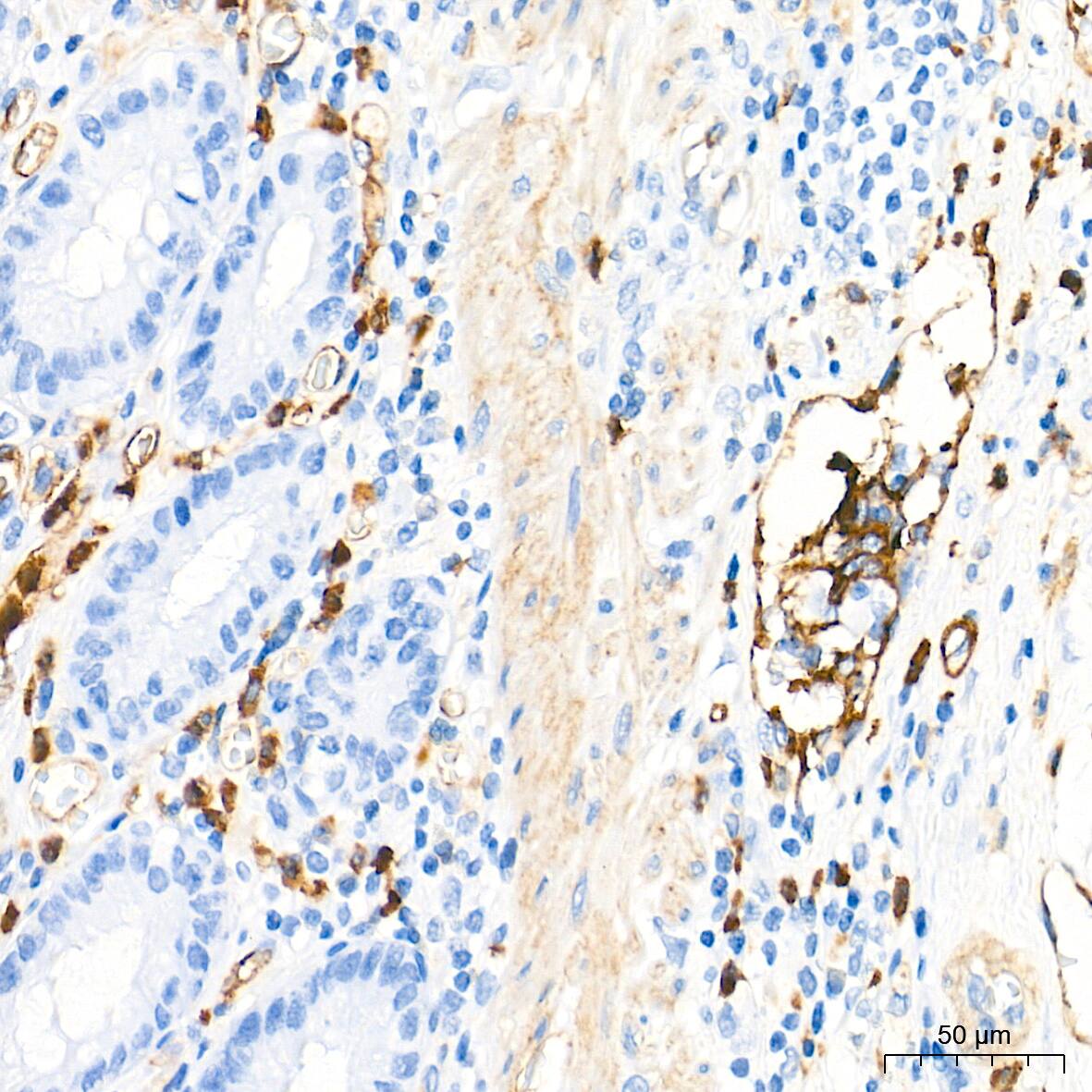 Dysferlin Antibody (3U1P9)