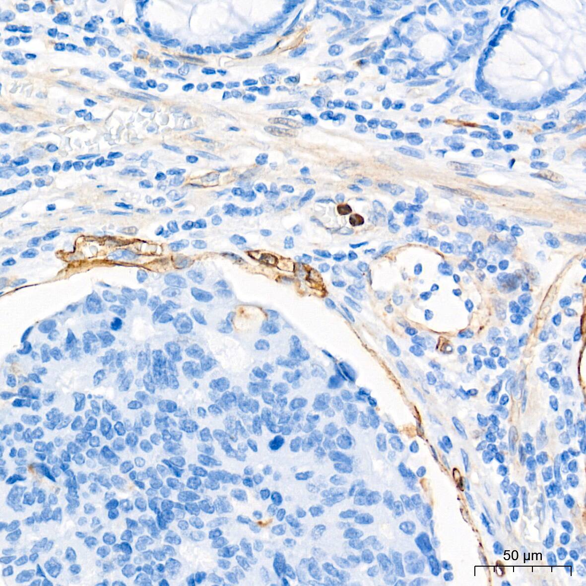 Dysferlin Antibody (3U1P9)