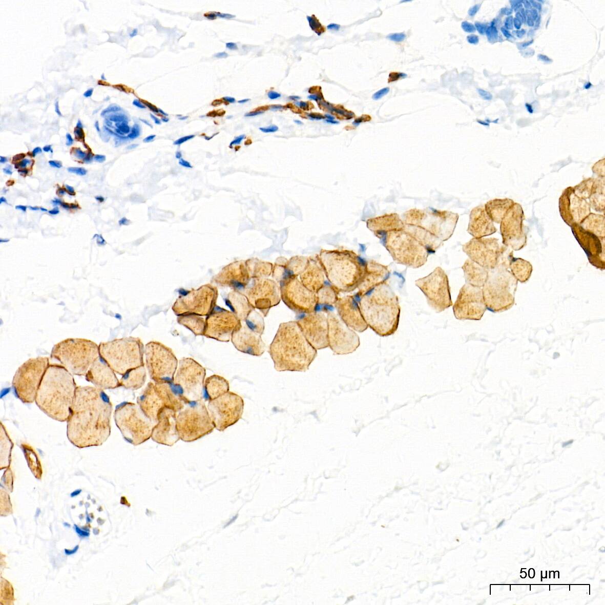 Dysferlin Antibody (3U1P9)