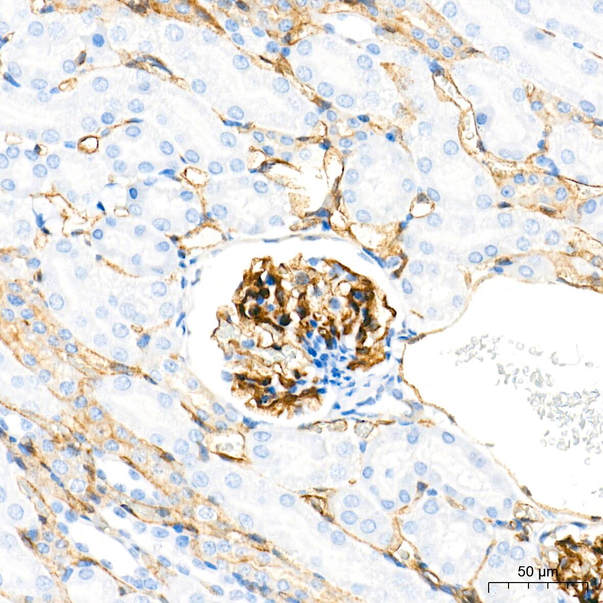 Dysferlin Antibody (3U1P9)