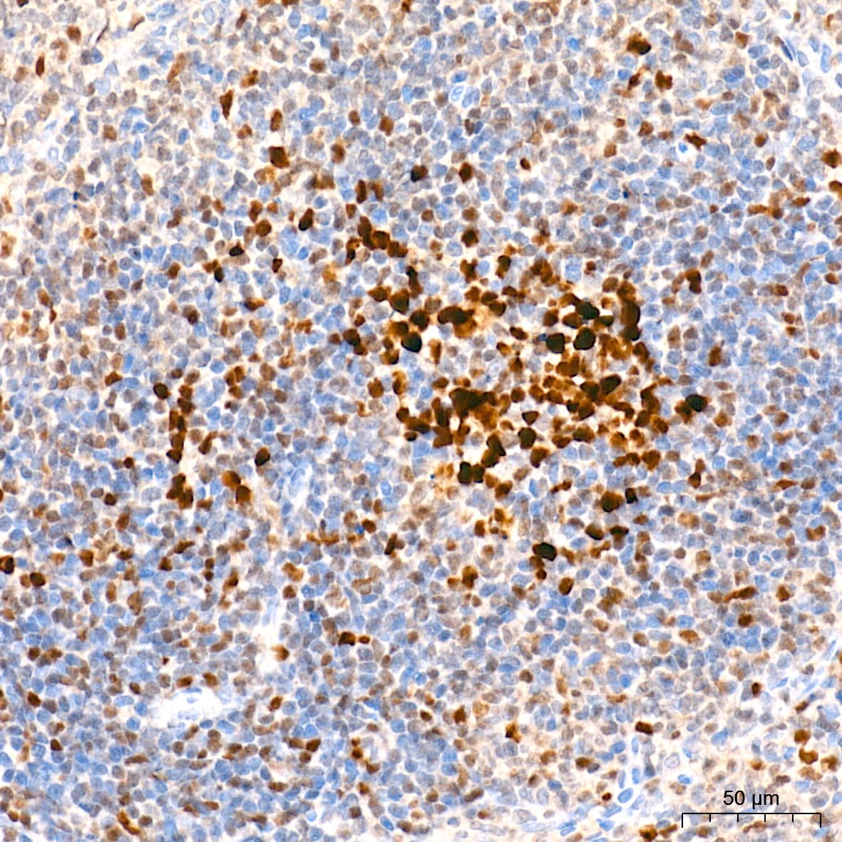 EZH2/KMT6 Antibody (9Q2R9)