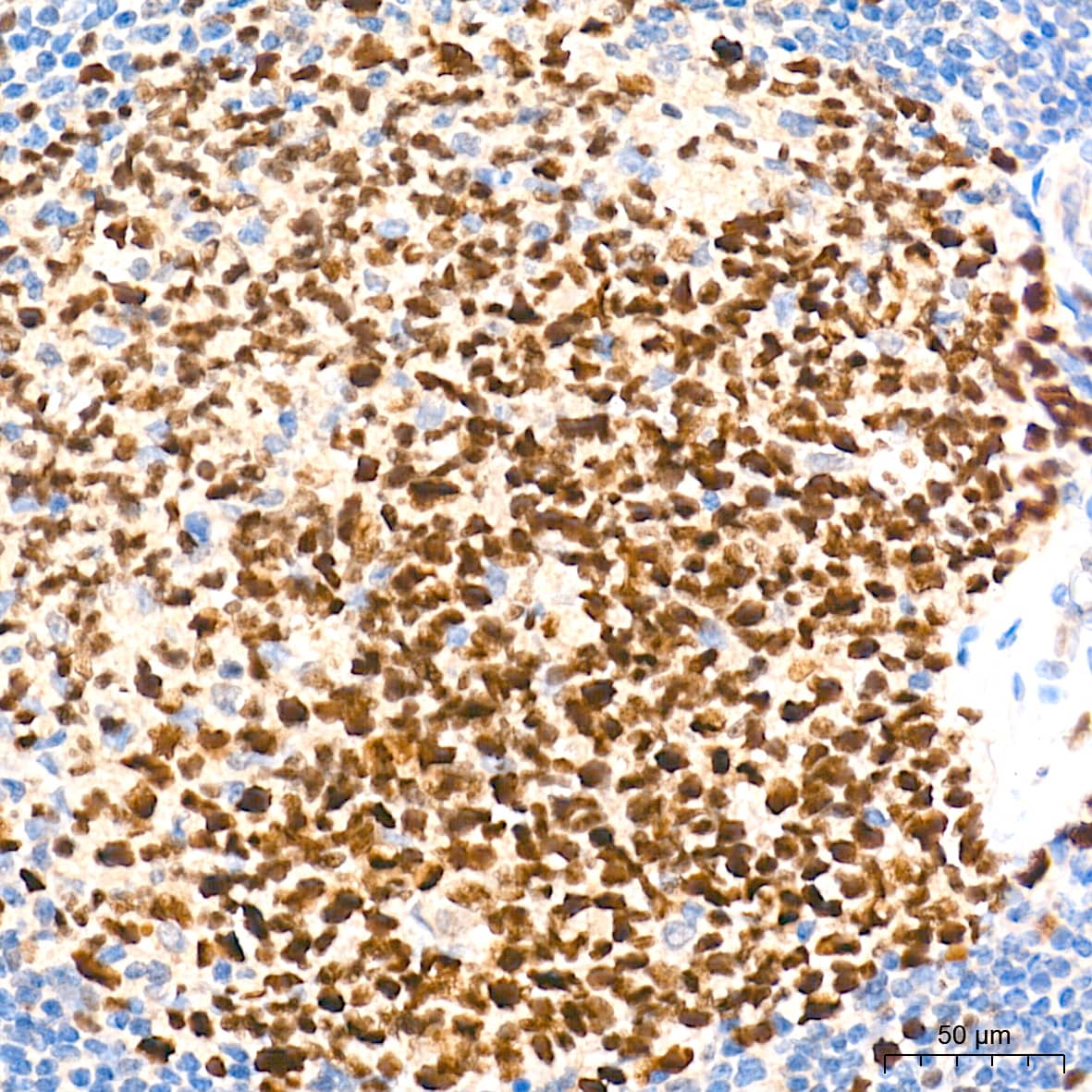 EZH2/KMT6 Antibody (9Q2R9)
