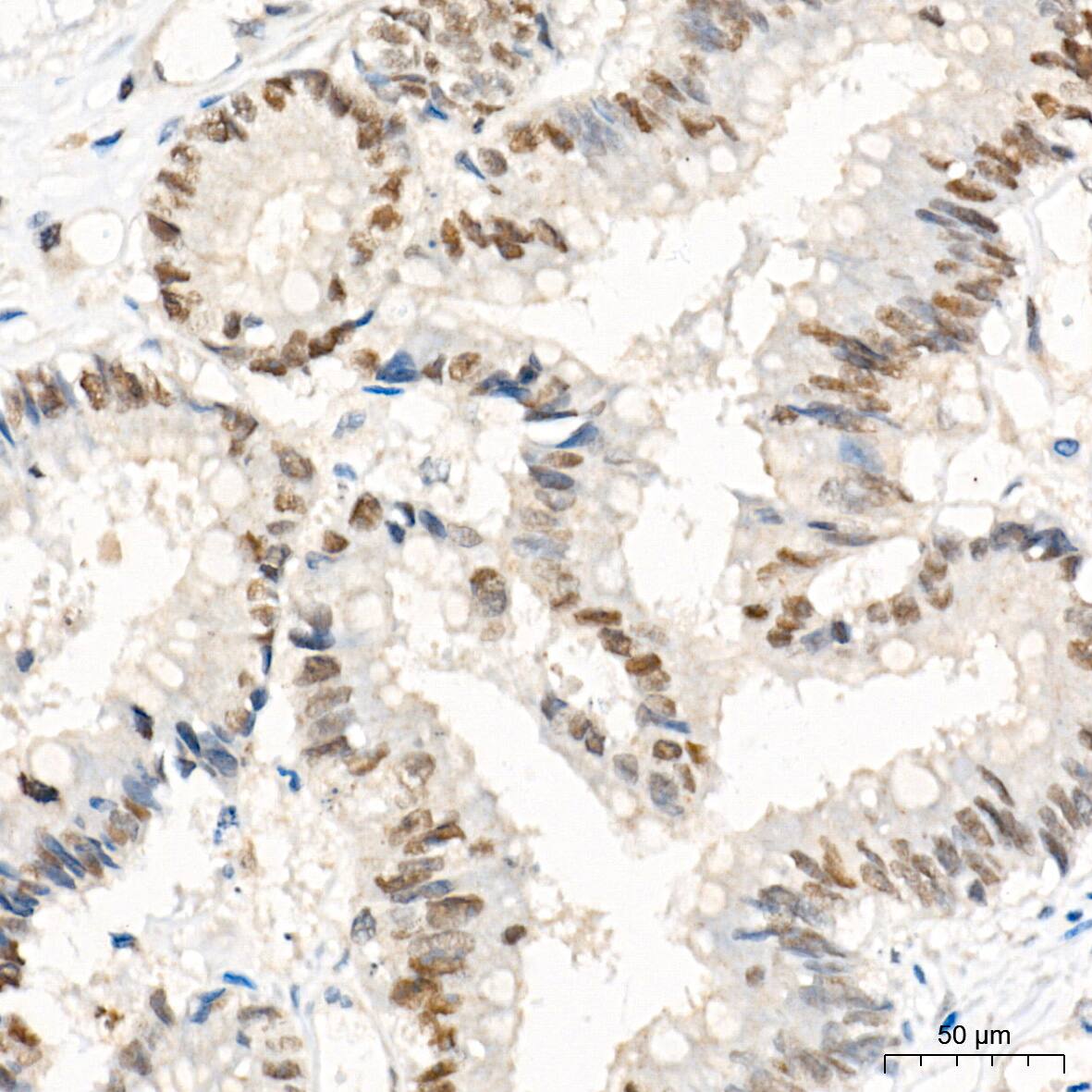 EZH2/KMT6 Antibody (9Q2R9)