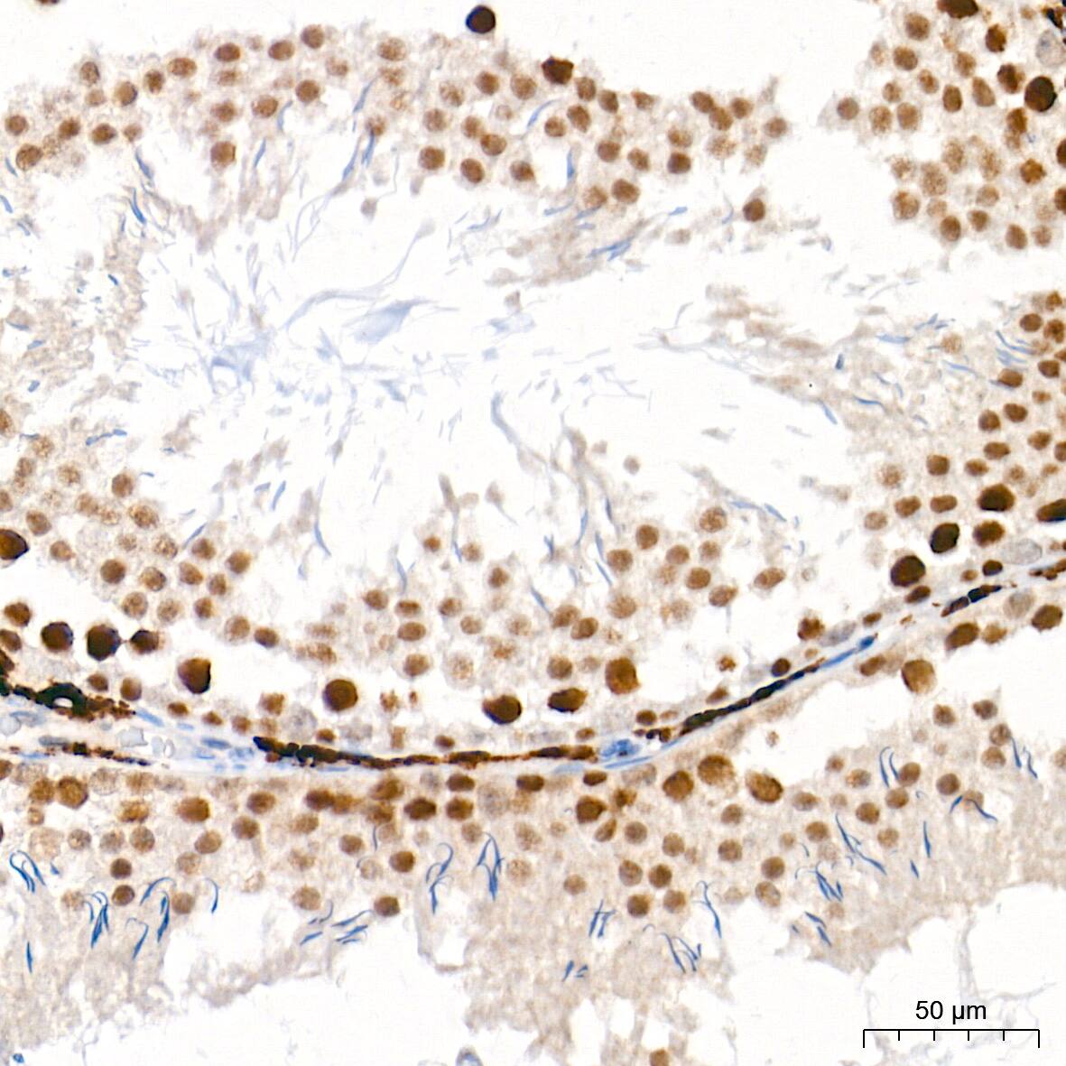 EZH2/KMT6 Antibody (9Q2R9)