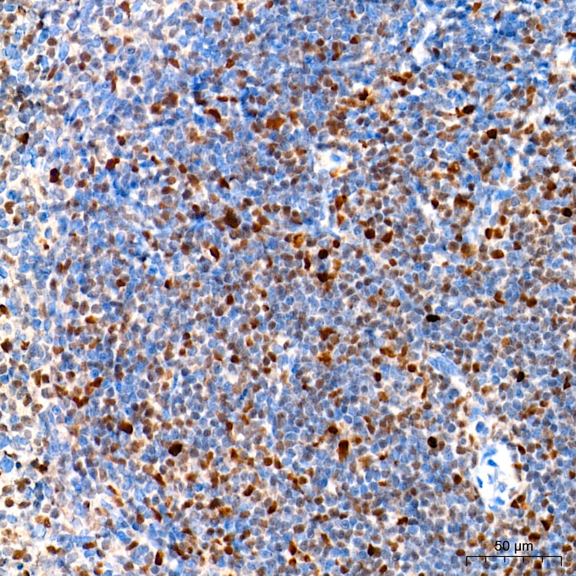 EZH2/KMT6 Antibody (9Q2R9)