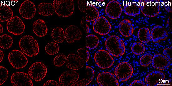 NQO-1 Antibody (9M3H10)