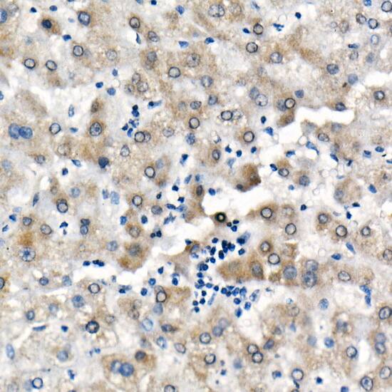 BNIP3 Antibody (2P7B8)