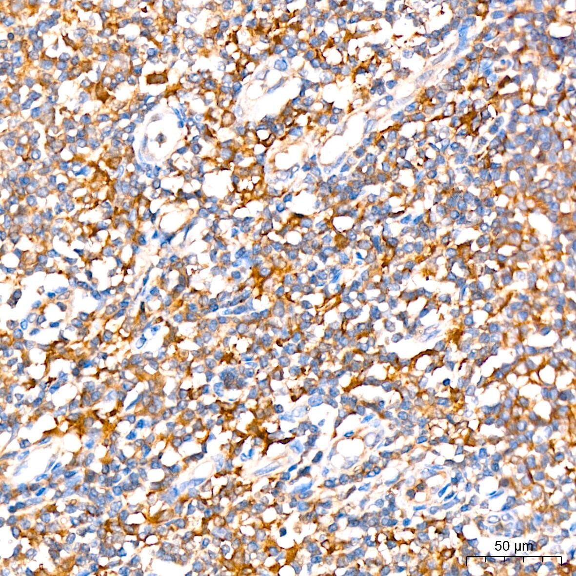 ATG3/APG3 Antibody (5D2W0)