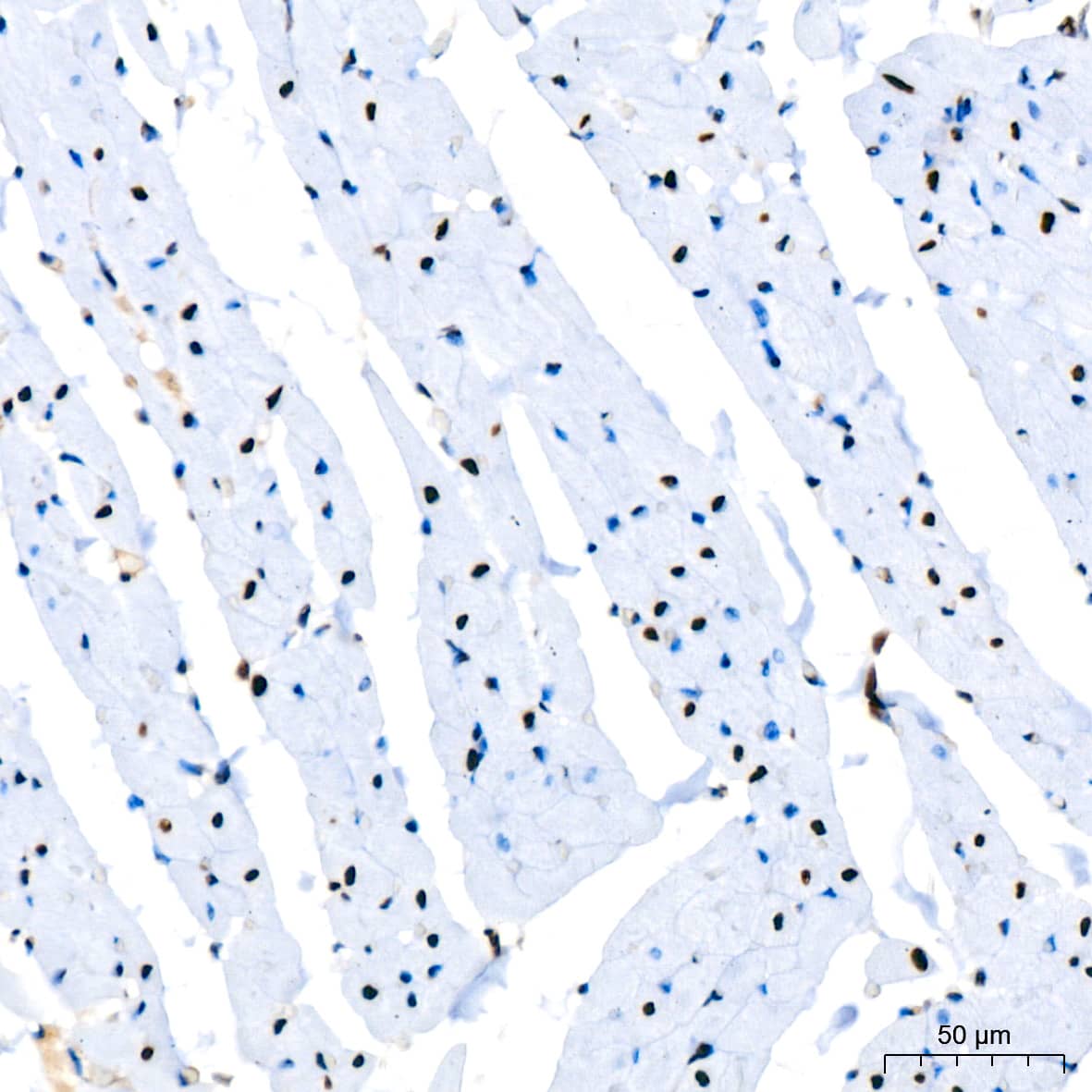 PARP Antibody (2G8N7)