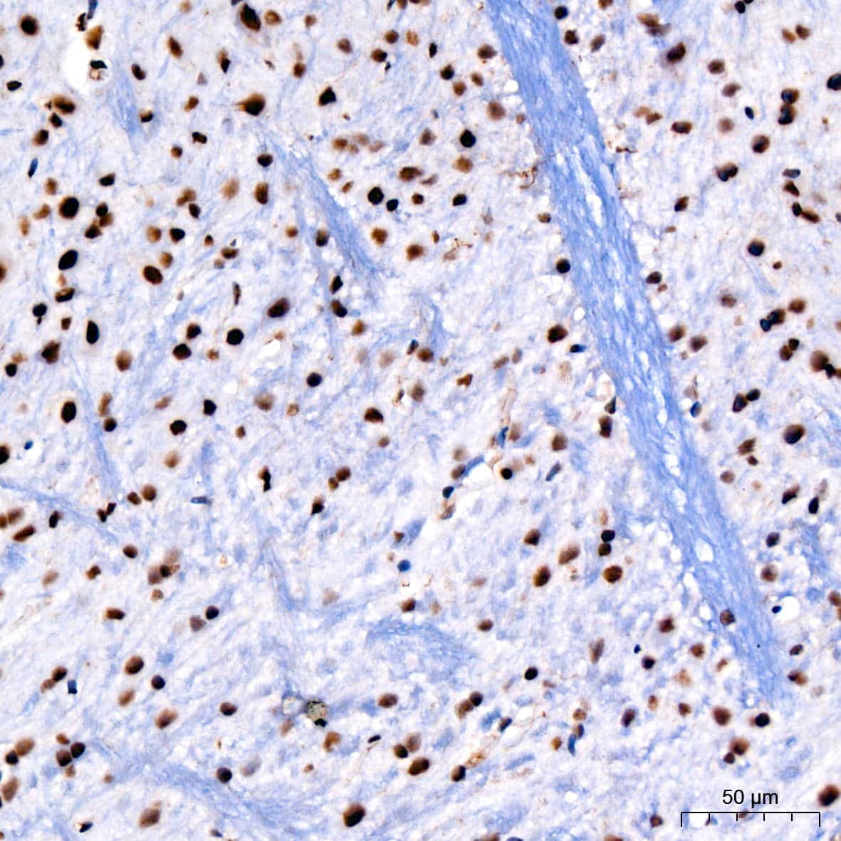 PARP Antibody (2G8N7)