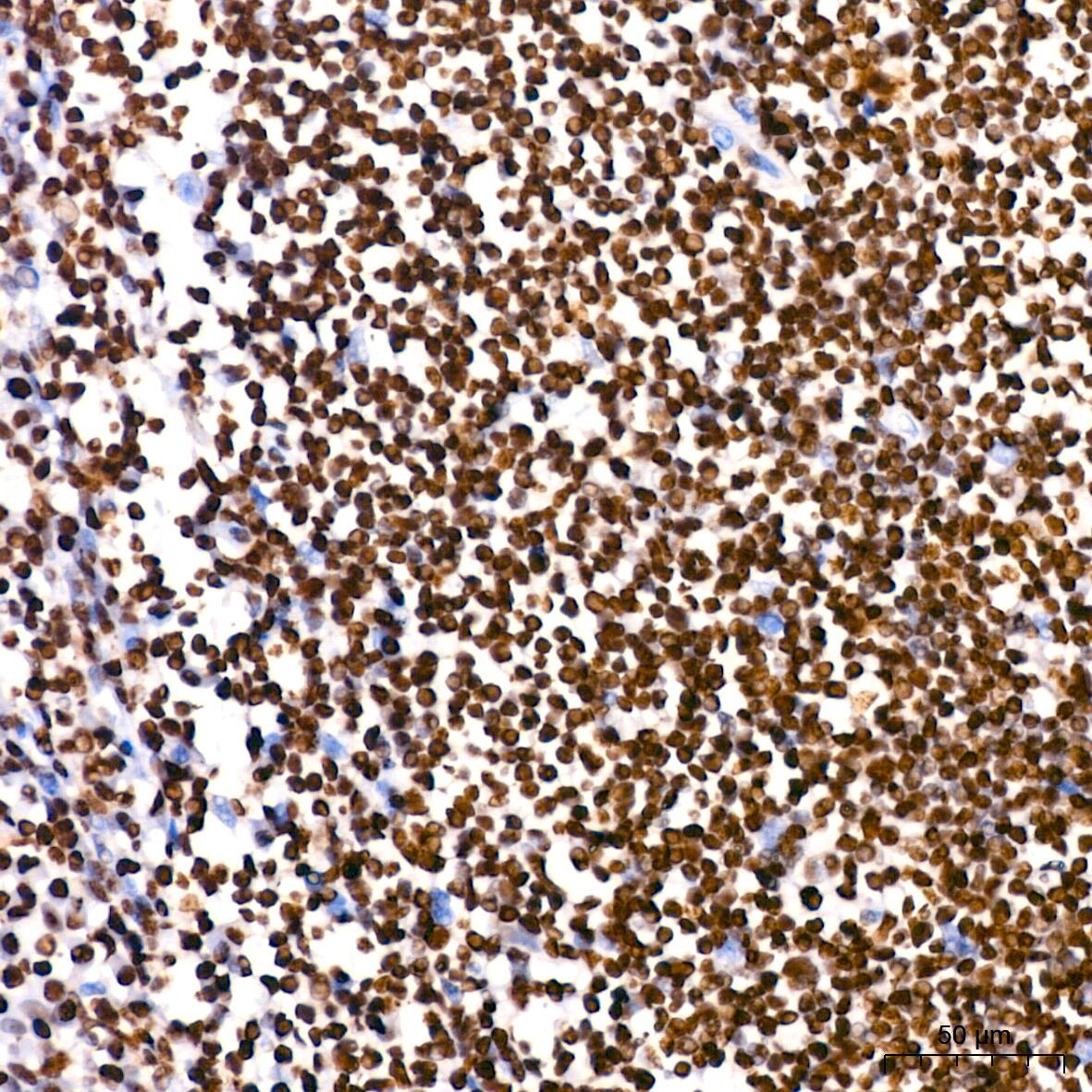 PARP Antibody (2G8N7)