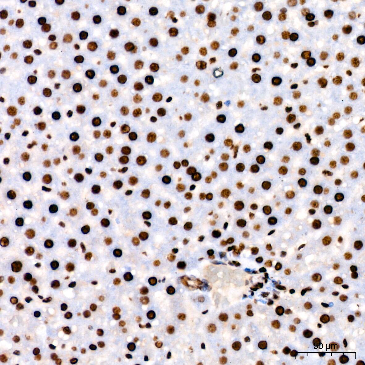 PARP Antibody (2G8N7)