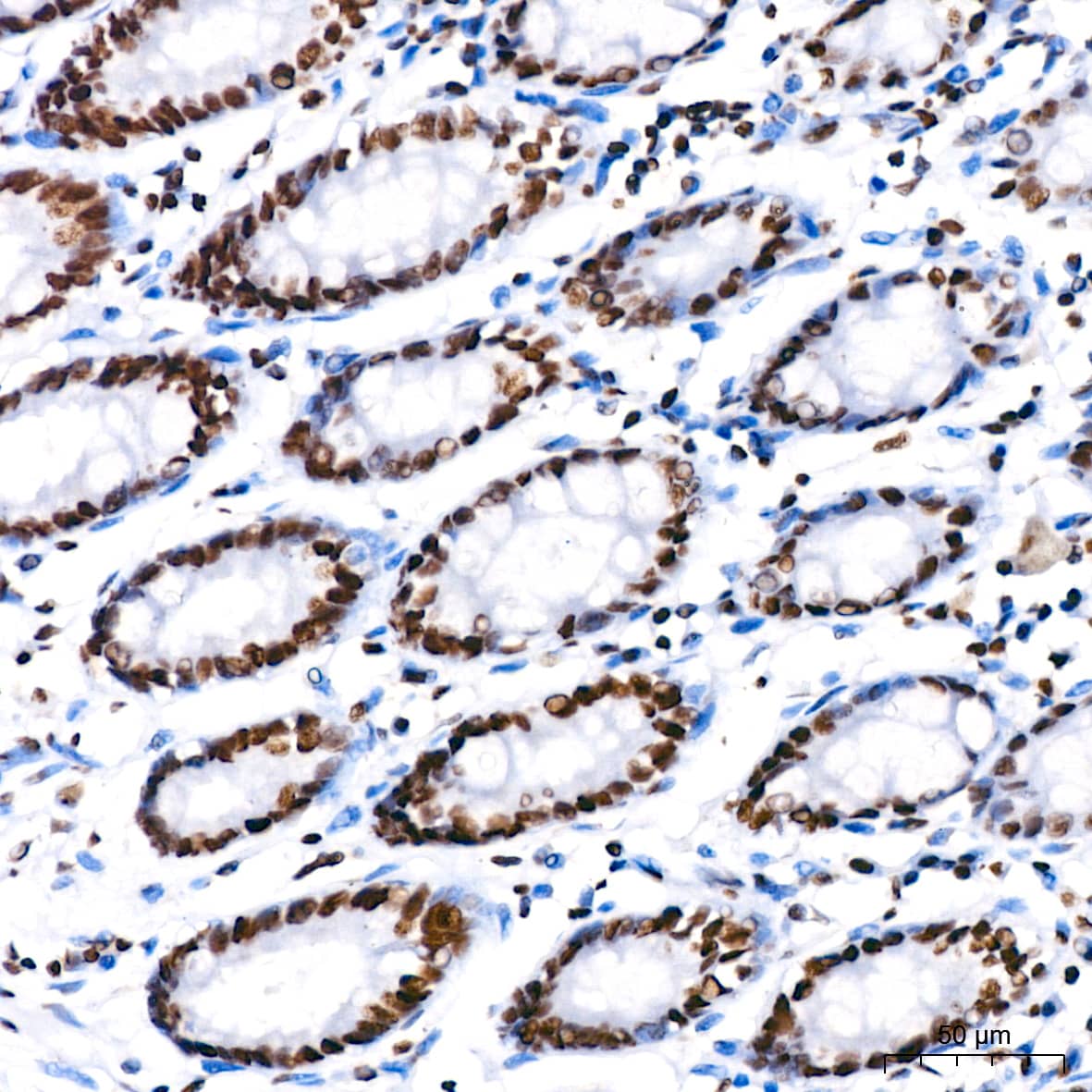 PARP Antibody (2G8N7)