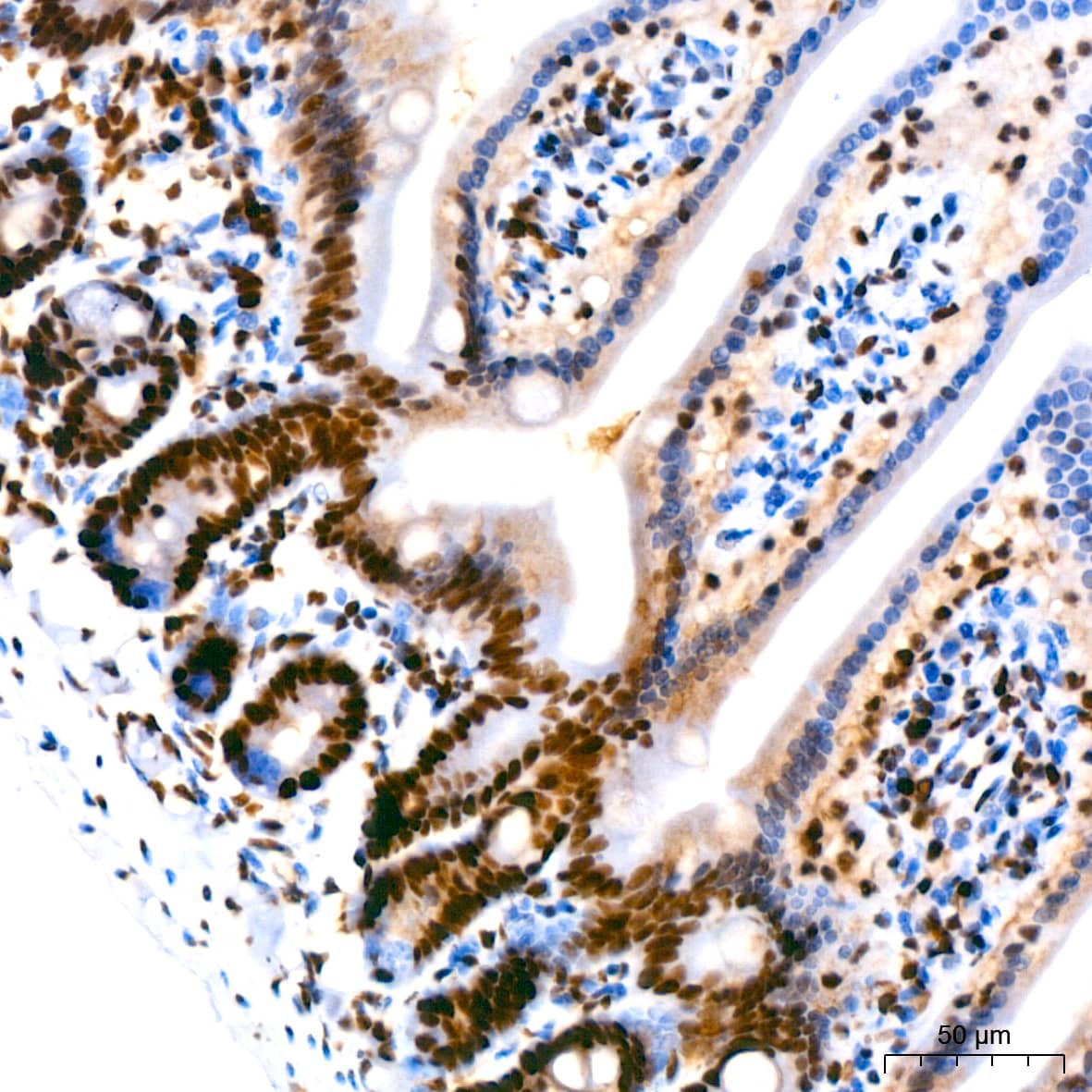 PARP Antibody (2G8N7)