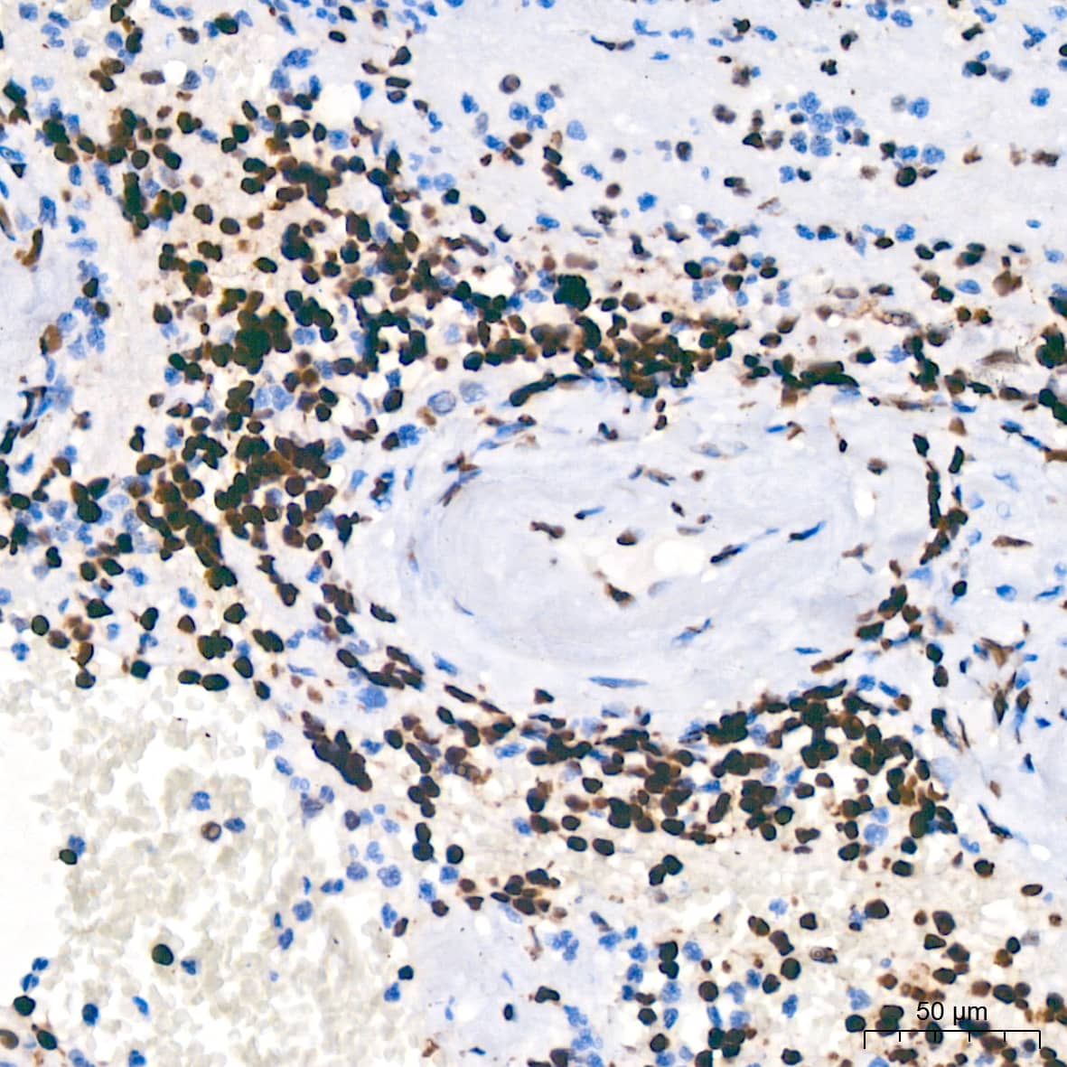 PARP Antibody (2G8N7)
