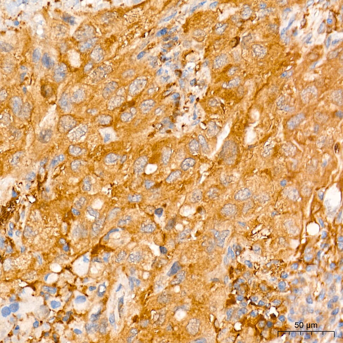 ATG7 Antibody (3X1W4)
