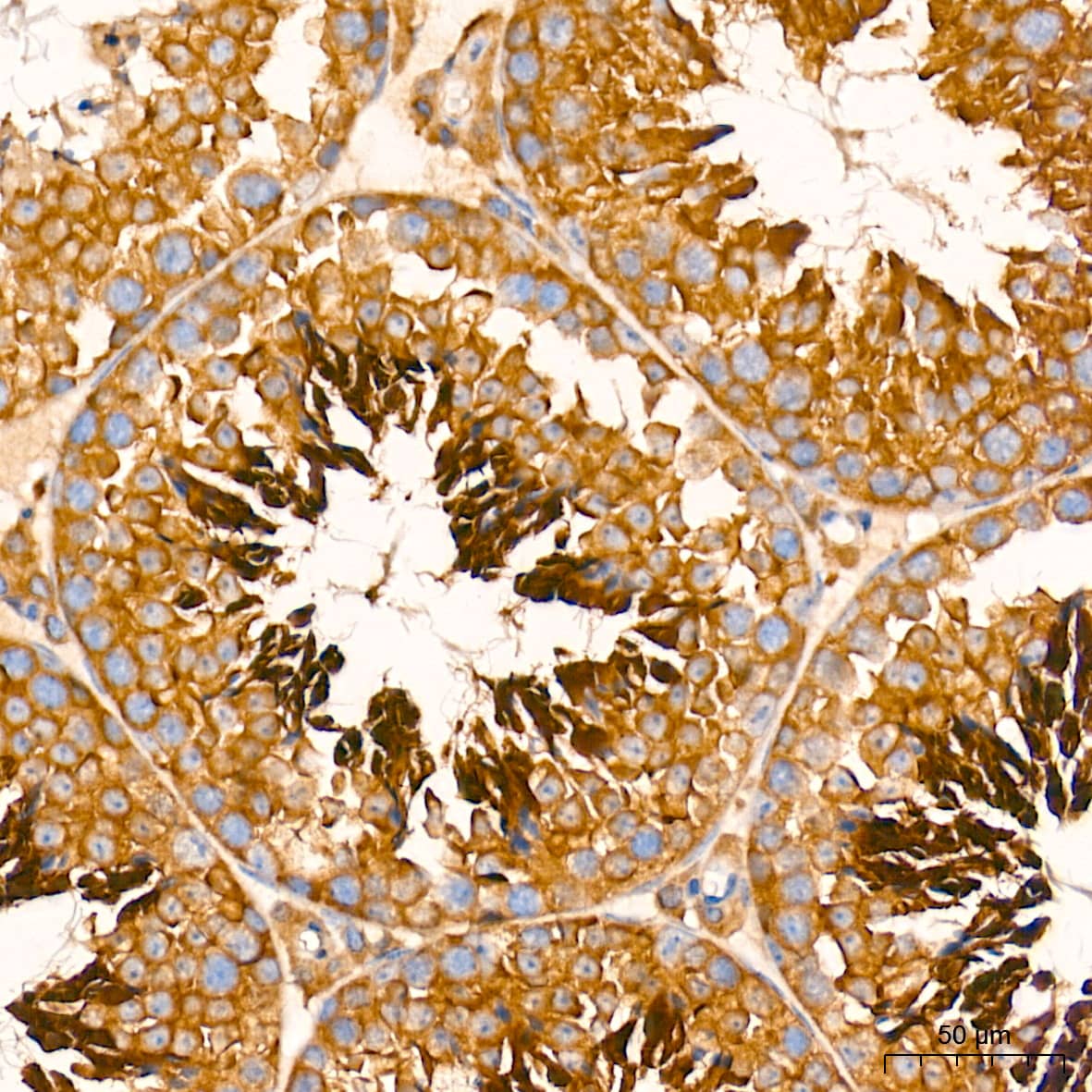 ATG7 Antibody (3X1W4)