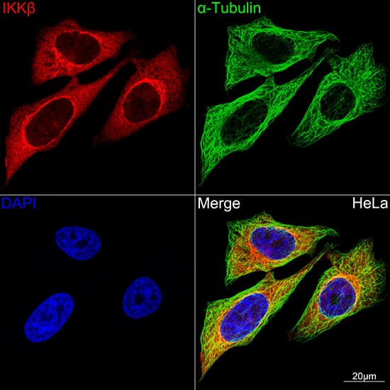 IKK beta Antibody (8X6V3)