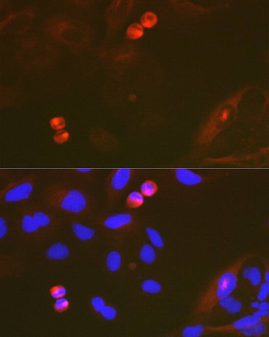 TACC3 Antibody (7S7L2)