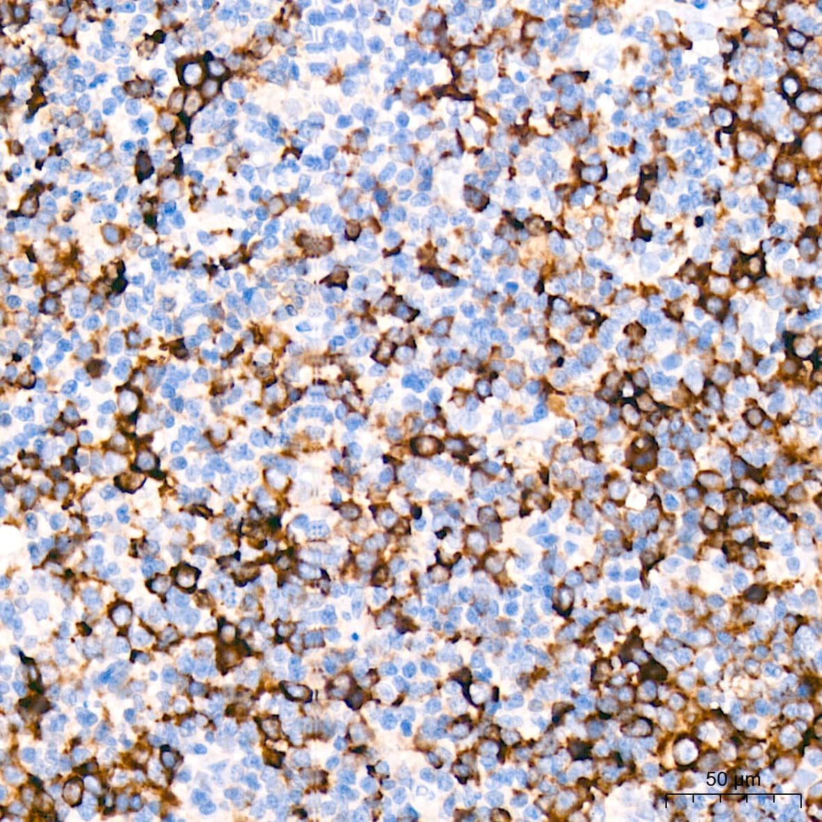 TACC3 Antibody (7S7L2)