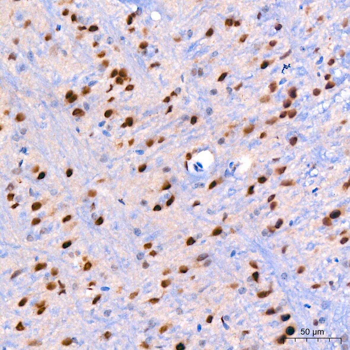 Cullin 3 Antibody (7W3E3)