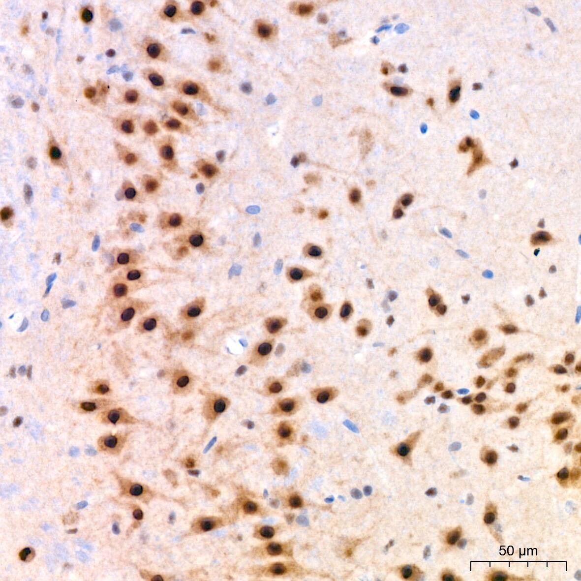 Cullin 3 Antibody (7W3E3)