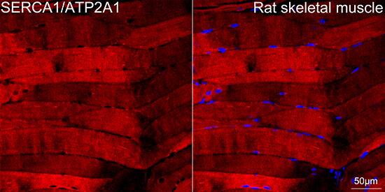 SERCA1 ATPase Antibody (2T8S3)
