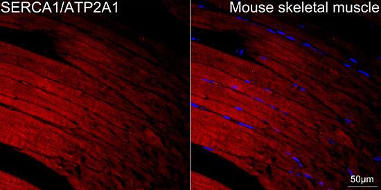 SERCA1 ATPase Antibody (2T8S3)