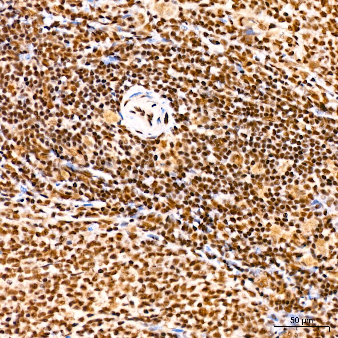 SP1 Antibody (5I3A8)