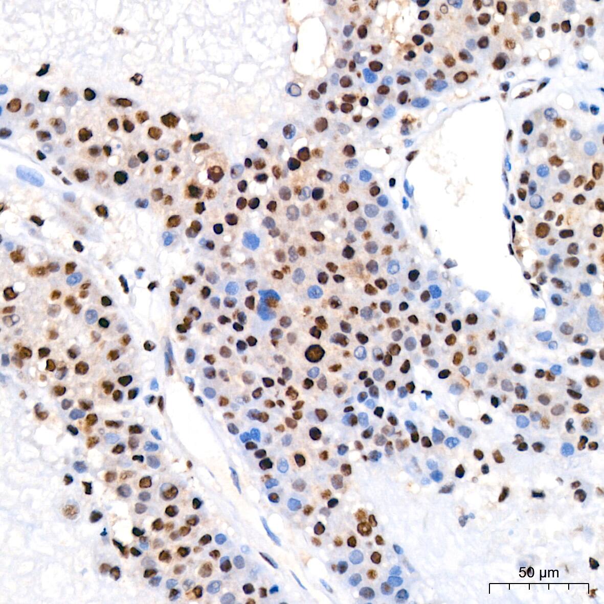 SP1 Antibody (5I3A8)