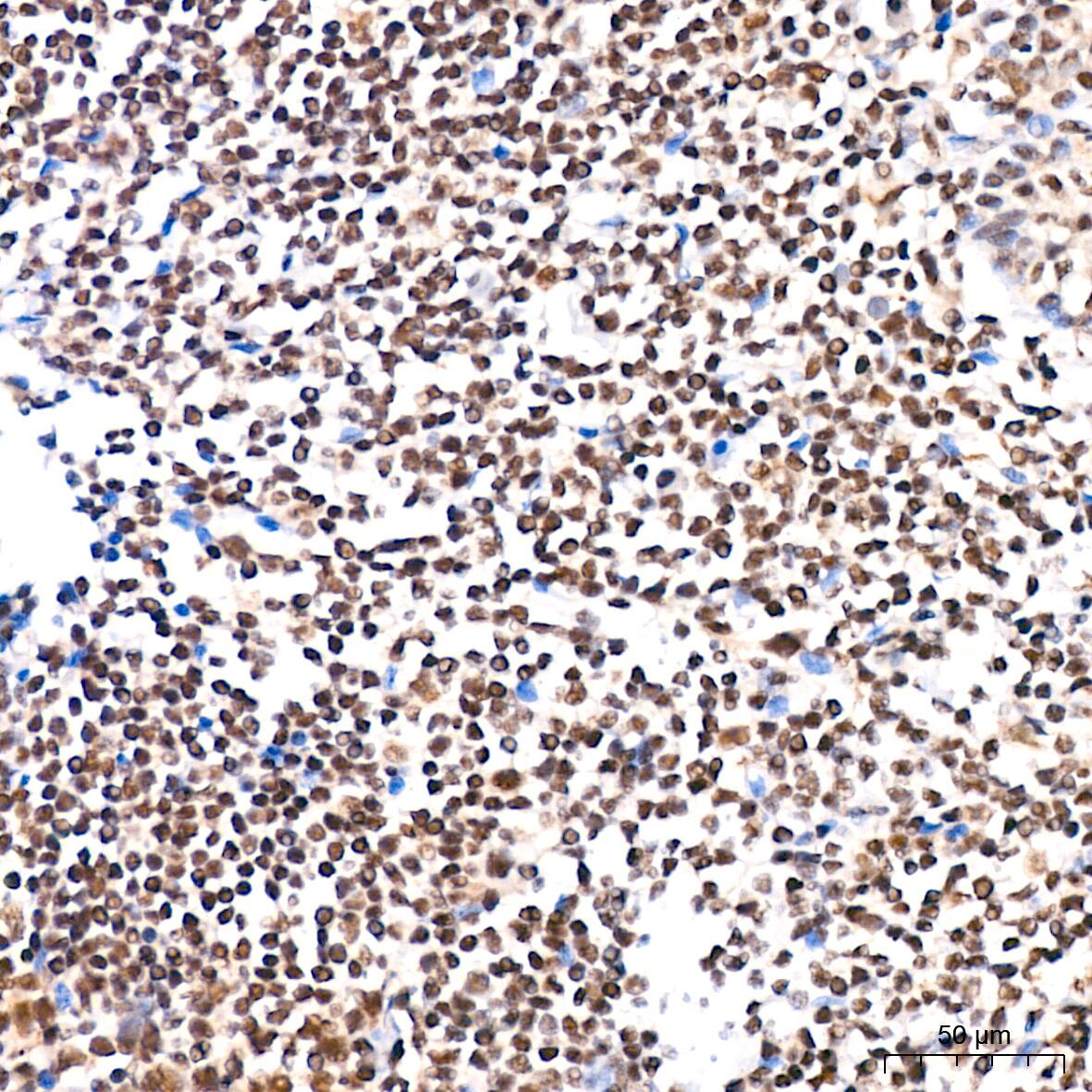 SP1 Antibody (5I3A8)