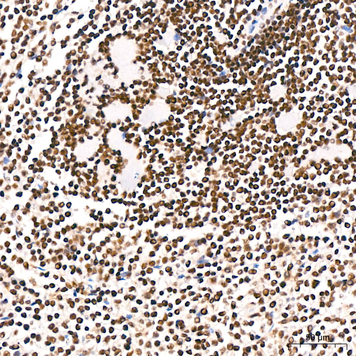 SP1 Antibody (5I3A8)