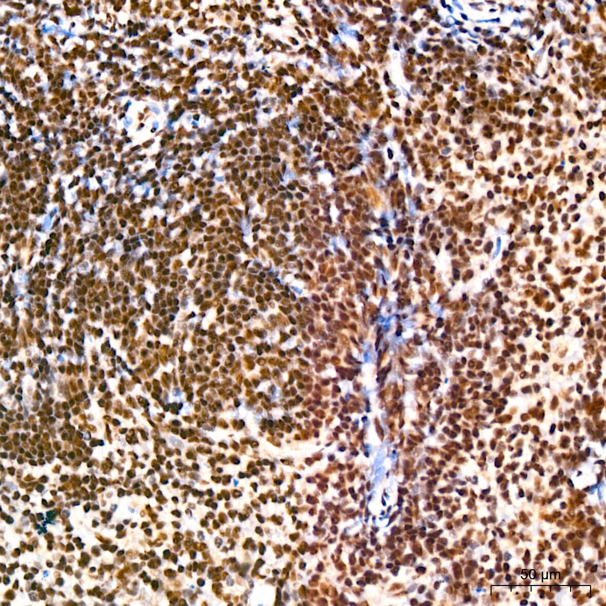 SP1 Antibody (5I3A8)