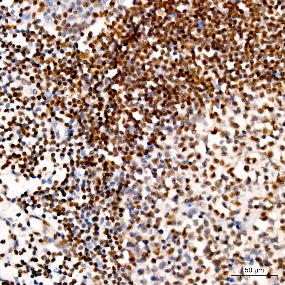 ATM Antibody (6P6C6)